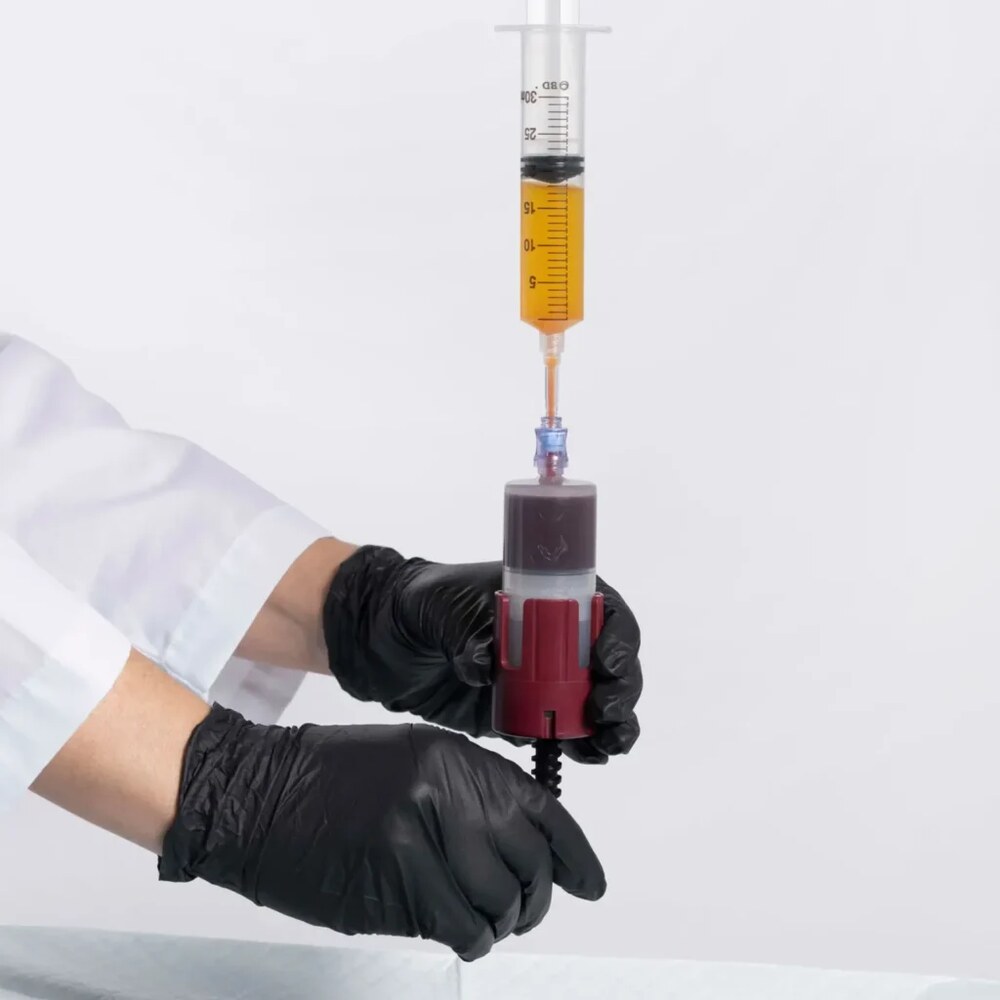 Decantazione del PRP con il sistema KeyPRP