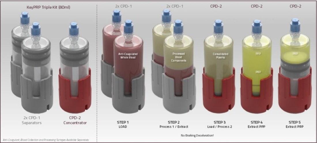 Panoramica del processo KeyPRP a doppia centrifugazione