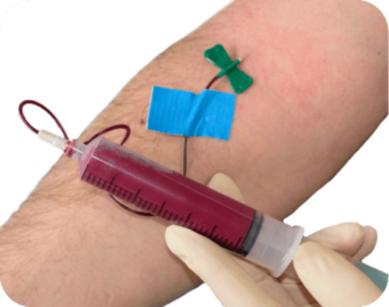 Prelievo del sangue