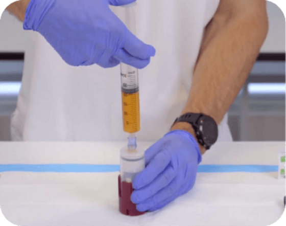 Riempimento del concentratore