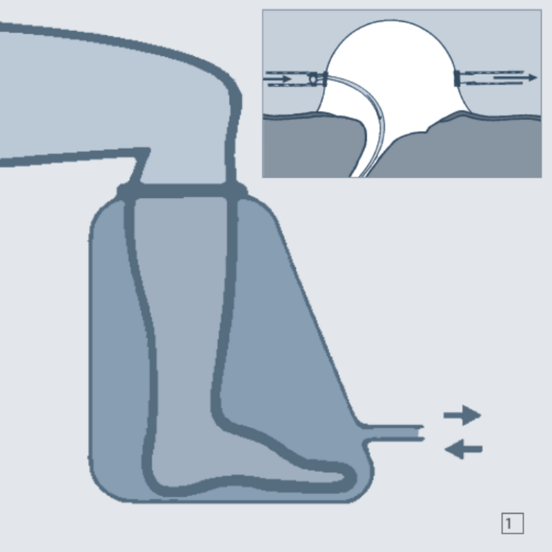 Schema d'impiego del bag: esposizione controllata dell'arto alla miscela ossigeno-ozono nella piccola camera iperbarica