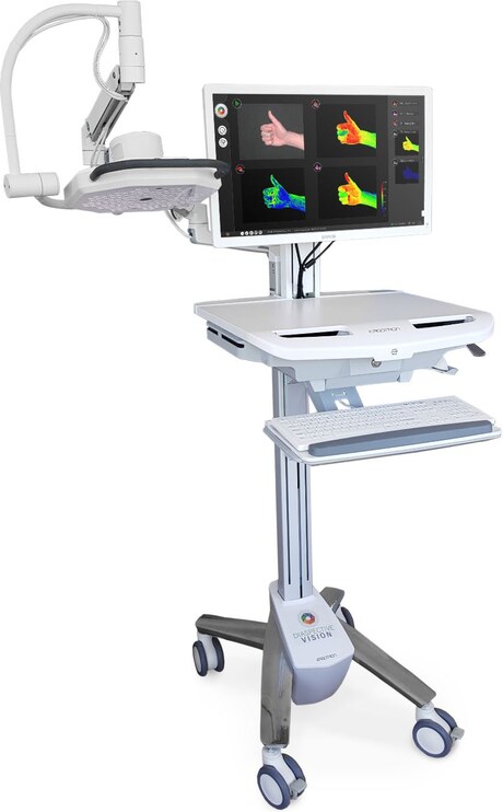 Sistema TIVITA Tissue su carrello