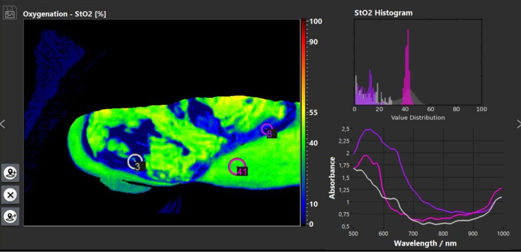 Analisi StO2 con valori puntuali in 3 punti selezionati, istogramma e curve di assorbanza