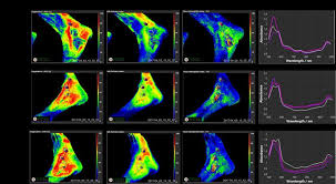 TIVITA tissue image report: mappe parametriche e curve spettroscopiche a confronto