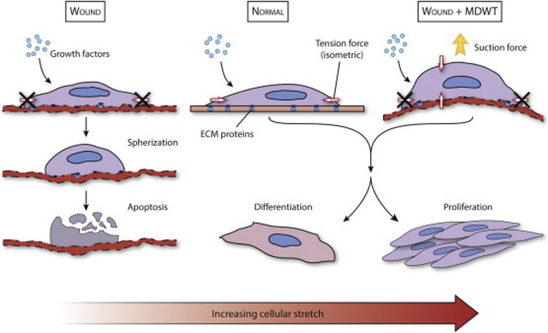 Effetto dello stiramento cellulare crescente (increasing cellular stretch): confronto fra ferita, condizione normale e ferita trattata con medicazione a pressione negativa, con apoptosi, differenziazione e proliferazione cellulare