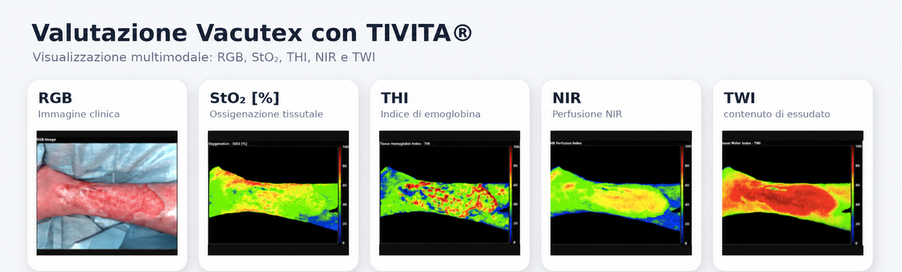 Valutazione Vacutex con sistema TIVITA®: imaging multimodale RGB, StO₂, THI, NIR e TWI di una lesione